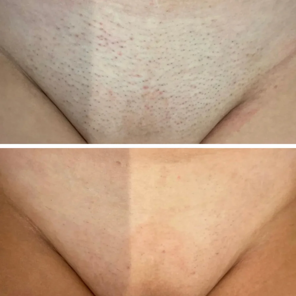 Klara Kosmetik™ | Haarwuchs-hemmendes Serum