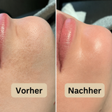 PeelShot™ | Exfolierende Reis-Ampulle für Poren & Glow