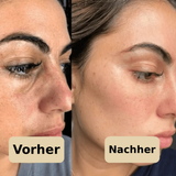 PeelShot™ | Exfolierende Reis-Ampulle für Poren & Glow